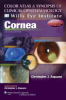 Cornea