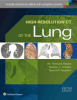High-resolution_CT_of_the_lung