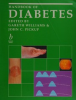 Handbook_of_diabetes