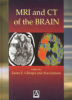 MRI_and_CT_of_the_brain