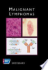 Atlas_of_clinical_oncology__malignant_lymphomas