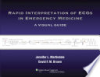 Rapid_interpretation_of_ECGs_in_emergency_medicine