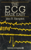 The_ECG_made_simple