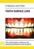 Tooth_surface_loss