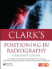 Clark_s_positioning_in_radiography