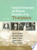 Computed_tomography_and_magnetic_resonance_of_the_thorax