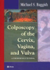 Colposcopy_of_the_cervix__vagina__and_vulva