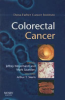 Colorectal_cancer