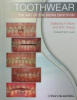 Toothwear
