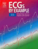 ECGs_by_example