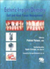 Esthetic_implant_dentistry