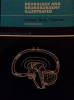 Neurology_and_neurosurgery_illustrated