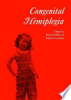Congenital_hemiplegia