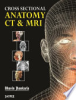 Cross_sectional_anatomy_CT___MRI