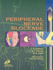 Peripheral_nerve_blockade