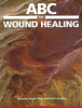 ABC_of_wound_healing