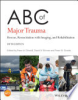 ABC_of_major_trauma