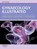 Gynaecology_illustrated