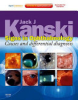 Signs_in_ophthalmology