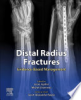 Distal_radius_fractures