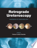 Retrograde_ureteroscopy