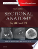 Sectional_anatomy_by_MRI_and_CT