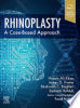 Rhinoplasty