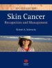 Skin_cancer