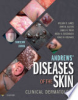Andrews__Diseases_of_the_skin