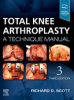 Total_knee_arthroplasty