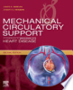 Mechanical_circulatory_support