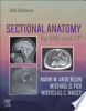 Sectional_anatomy_by_MRI_and_CT